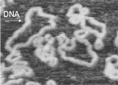 ADN